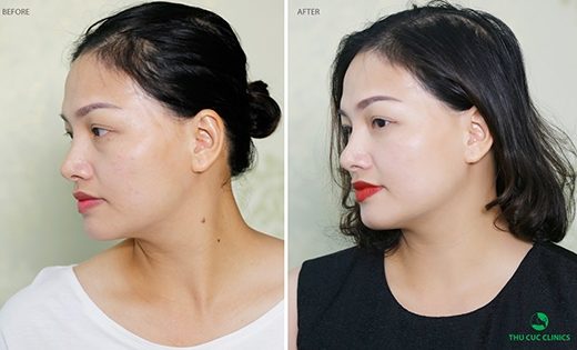 hinh_anh_1_520x315